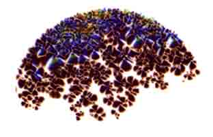 TGB Brain